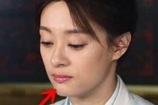 下巴有痣的明星网红,揭秘下巴有痣的明星网红魅力风采”