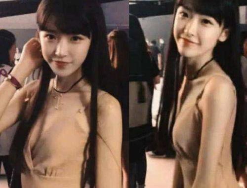 明星网红拔罐图片高清,揭秘高清图中的健康奥秘